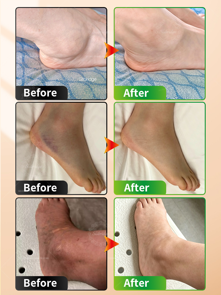 Portable Heated Ankle Massager - огляд і ціна Ankle Mobility Band